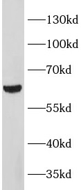      anti- METTL14 antibody