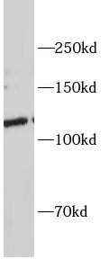      anti- NOTCH2 antibody