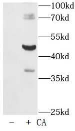 Phospho-Tau-T181 抗体