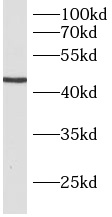      anti- B3GNT5 antibody