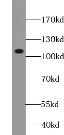      anti- CD133 antibody