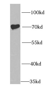      anti- IGF2BP1 antibody