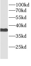      anti- BMI1 antibody