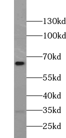      anti- USP21 antibody