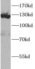      anti- Vinculin antibody