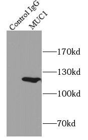      anti- MUC1 antibody