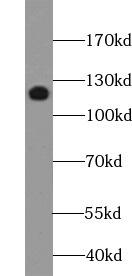      anti- MUC1 antibody