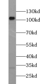      anti-TLR2 antibody