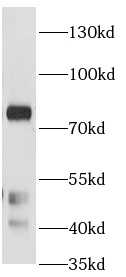      anti- KPCA antibody