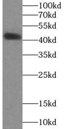      anti- SSTR2 antibody