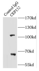 CEP152抗体