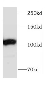      anti- CEP152 antibody