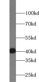      anti- FAS/CD95 antibody