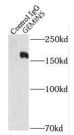      anti- GEMIN5 antibody