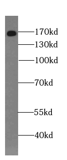      anti- GEMIN5 antibody