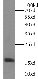      anti- Prealbumin/transthyretin antibody