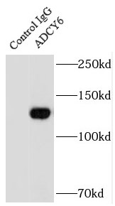 ADCY6抗体