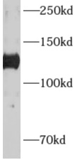      anti- ADCY6 antibody