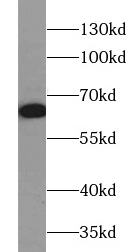      anti-Pan-AKT antibody