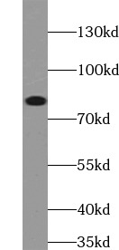      anti- MLH1 antibody