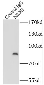      anti- MLH1 antibody