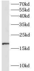 anti- IL-7 antibody