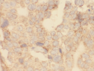 anti- RCAS1 antibody