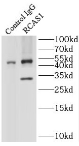 RCAS1抗体