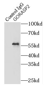      anti- GORASP2 antibody