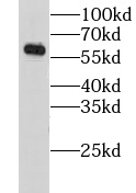      anti- GORASP2 antibody