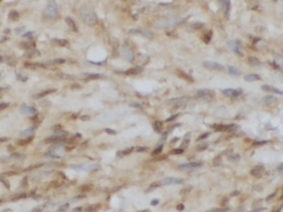      anti- GS28 antibody