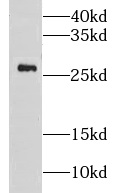      anti- GS28 antibody