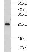      anti- GOSR2/Membrin antibody