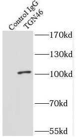 TGN46抗体