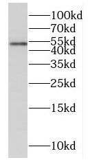      anti- FTCD antibody