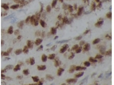 PARP1抗体