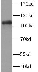      anti- PARP1 antibody