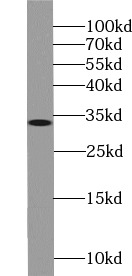      anti- XRCC2 antibody
