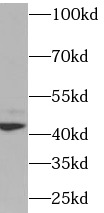      anti- XRCC4 antibody