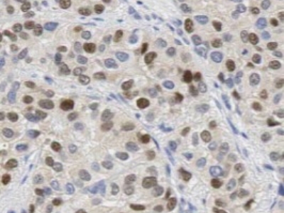      anti- XRCC4 antibody