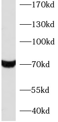 anti- KU70 antibody