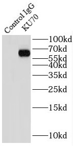      anti- KU70 antibody