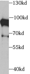      anti- XRCC5/Ku80 antibody