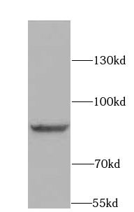      anti- BRCA1 antibody