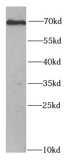      anti- Chk2 antibody