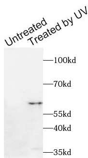      anti- Phospho-CHEK1-S280 antibody