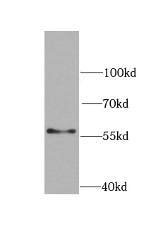      anti- Chk1 antibody