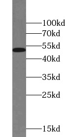      anti- Chk1 antibody