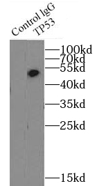      anti- TP53 antibody