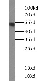      anti- TP53 antibody